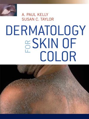 cover image of Dermatology for Skin of Color